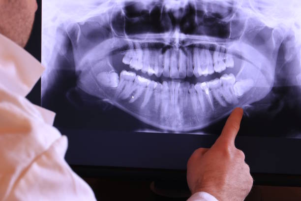 Best Orthodontic Emergency Dentist in Seabrook, TX