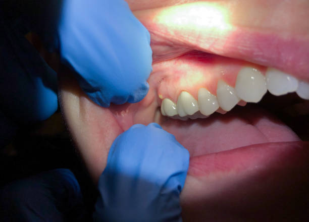 Best Emergency Dentist for Special Needs Patients in Seabrook, TX